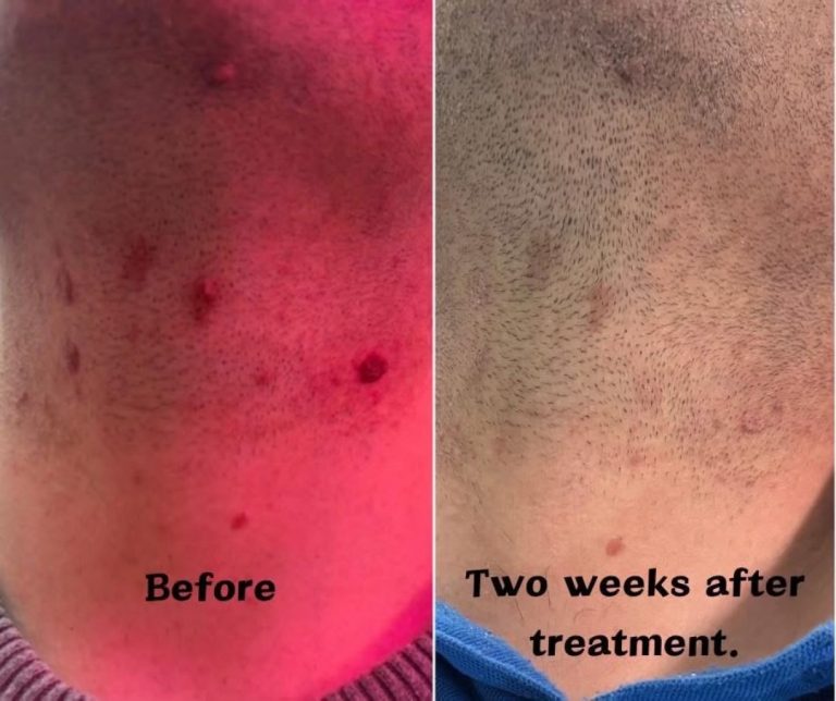 {"data":{"product":"tiktok"}}